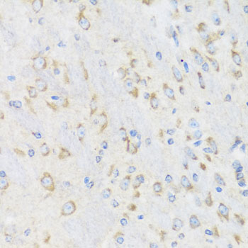 Anti-CHIC2 Polyclonal Antibody (CAB7971)