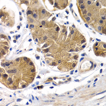 Anti-PTGIR Antibody (CAB1849)