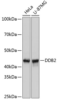 Anti-DDB2 Antibody