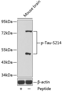 Anti-Phospho-MAPT-S214 Antibody (CABP0169)