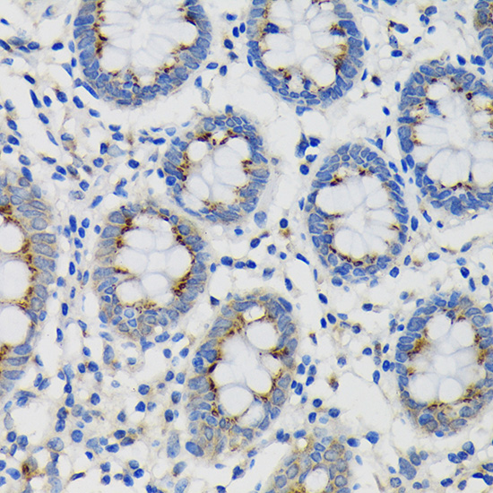 Anti-SDF4 Antibody (CAB15443)