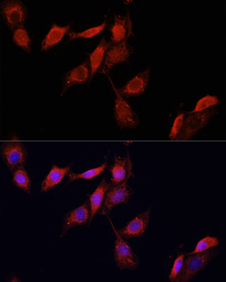 Anti-GPER1 Antibody (CAB10217)