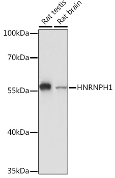 Anti-HNRNPH1 Antibody (CAB5924)