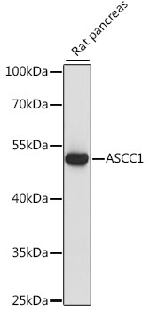 Anti-ASCC1 Antibody (CAB15832)