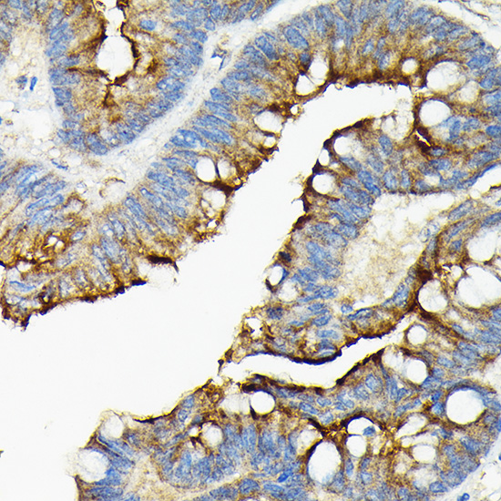 Anti-ACE2 Antibody (CAB12737)