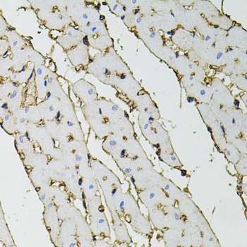 Anti-ANXA2 Antibody [KO Validated] (CAB1572)