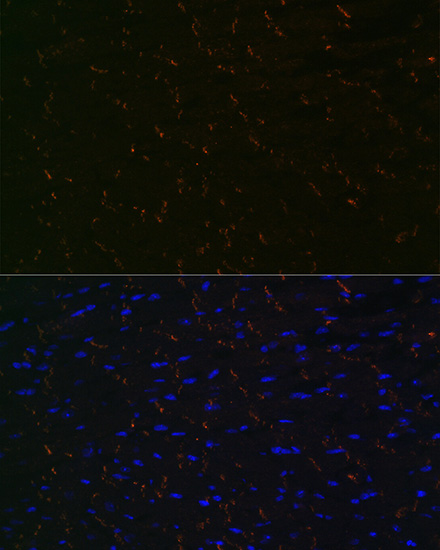 Anti-N-Cadherin Antibody [KO Validated] (CAB19083)