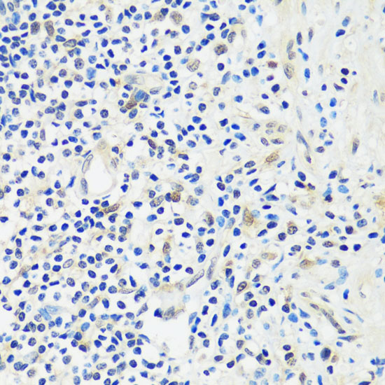 Anti-ASCL4 Antibody (CAB14439)