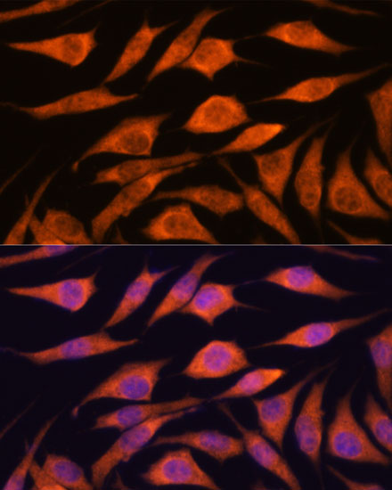 Anti-UPF3A Antibody (CAB15893)