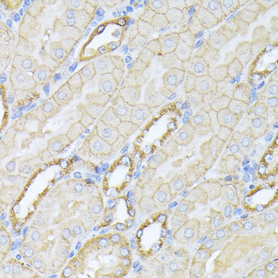 Anti-SPTAN1 Antibody (CAB0160)