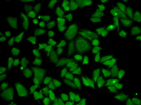 Anti-ALDH2 Antibody (CAB1226)