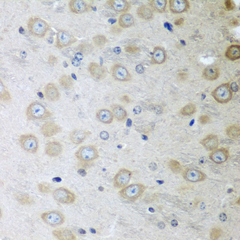 Anti-ATAD3A Polyclonal Antibody (CAB8230)