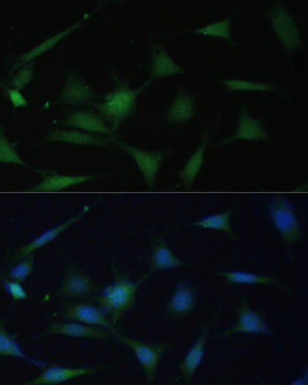 Anti-p38 MAPK Antibody [KO Validated] (CAB14401)