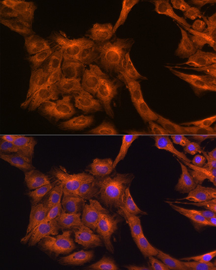 Anti-Tubulin alpha 1b Antibody