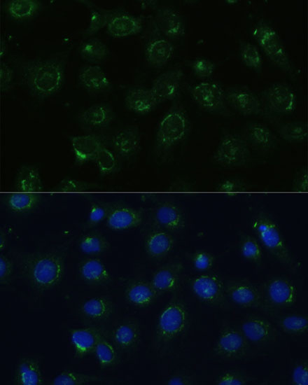 Anti-COPG2 Antibody (CAB15816)