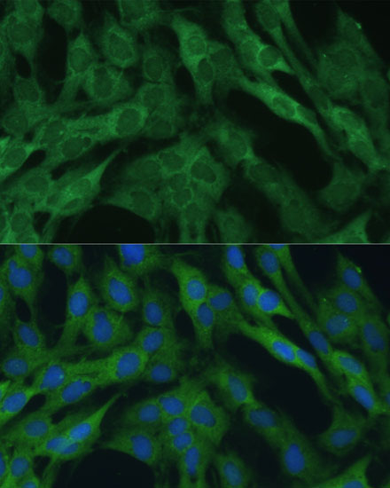 Anti-IDH1 Antibody [KO Validated] (CAB13245)