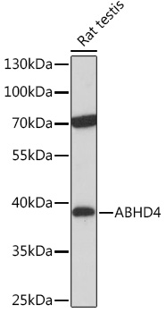 Anti-ABHD4 Antibody (CAB17751)