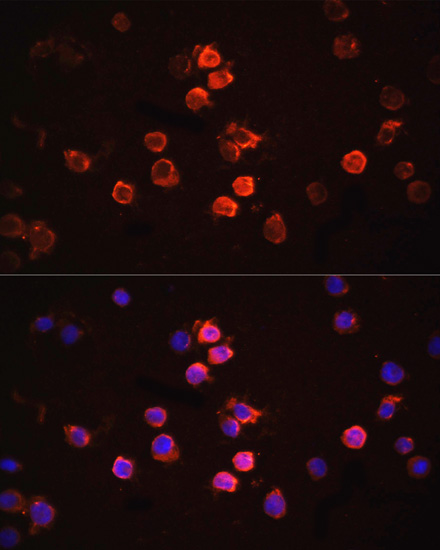 Anti-IL-1 beta Antibody (CAB11370)