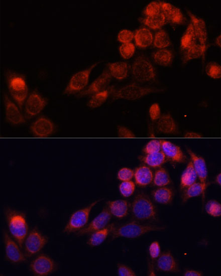 Anti-SLC16A4 Antibody (CAB14818)