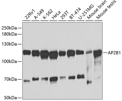 Anti-AP2B1 Antibody (CAB1995)