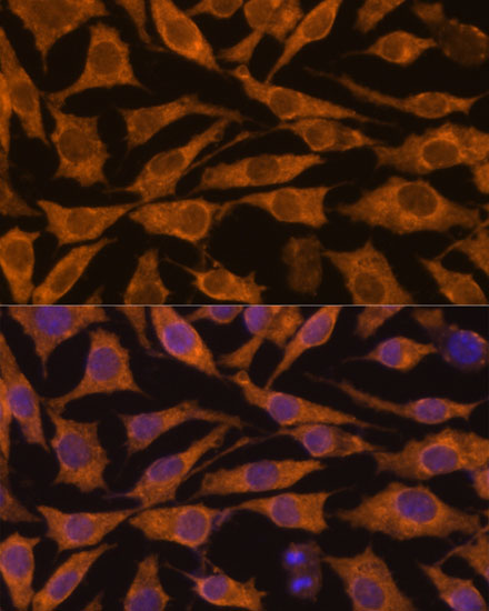 Anti-ZC3H7A Antibody (CAB13190)