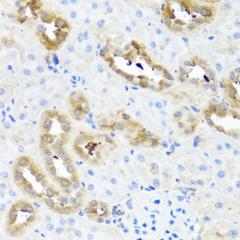 Anti-FABP5 Antibody (CAB0947)