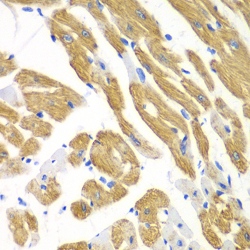 Anti-AIMP1 Antibody (CAB5301)