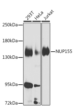 Anti-NUP155 Antibody (CAB7764)