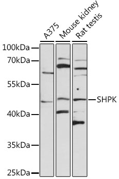 Anti-SHPK Polyclonal Antibody (CAB8823)