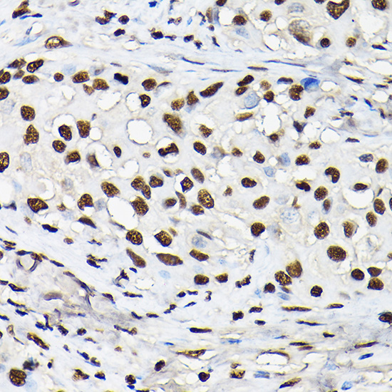 Anti-Histone H3 Antibody (CAB2352)