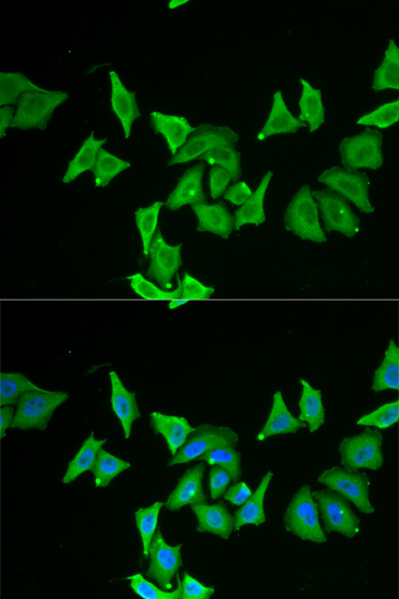 Anti-MLN Antibody (CAB6388)