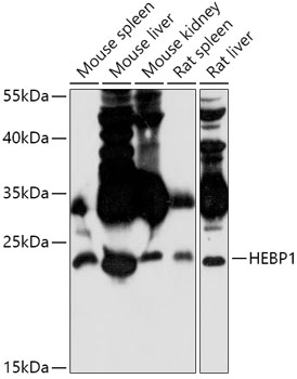 Anti-HEBP1 Antibody (CAB17698)