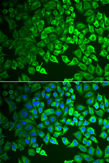 Anti-GIF Antibody (CAB6914)