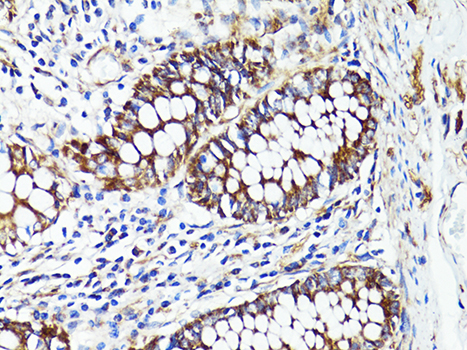 Anti-S100A10 Antibody (CAB14658)