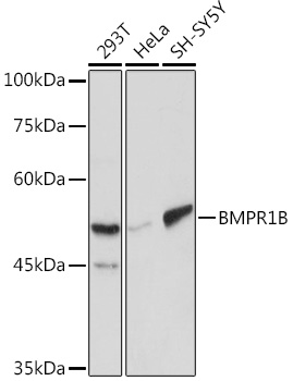 Anti-BMPR1B Antibody (CAB2005)
