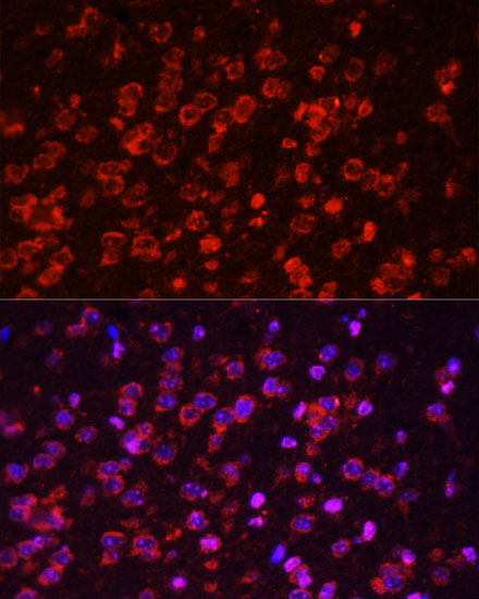 Anti-STAT3 Antibody [KO Validated] (CAB1192)