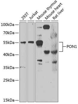 Anti-PON1 Antibody (CAB7338)