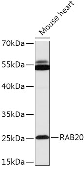 Anti-RAB20 Antibody (CAB17725)