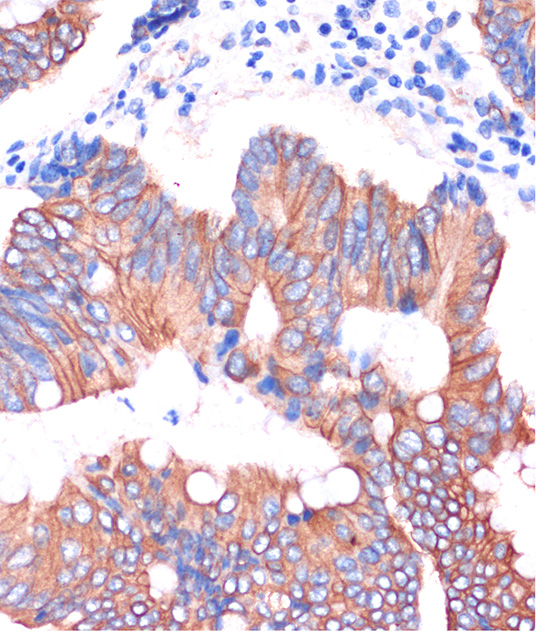 Anti-CGN Antibody (CAB15489)