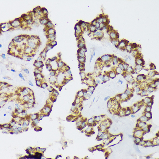 Anti-SEPT8 Antibody (CAB15011)