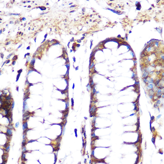 Anti-GPX4 Antibody (CAB13309)