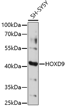 Anti-HOXD9 Antibody (CAB16879)