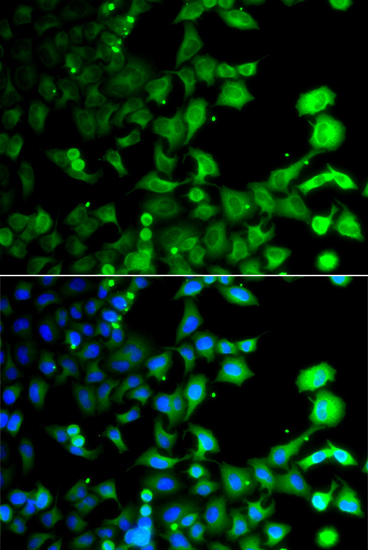 Anti-GABARAPL2 Antibody (CAB7782)