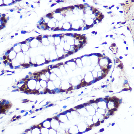 Anti-APIP Antibody (CAB7102)