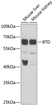 Anti-BTD Antibody (CAB6284)