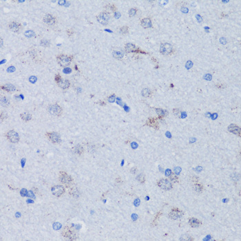 Anti-TFAM Antibody (CAB13552)