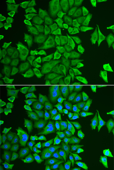 Anti-APEH Antibody (CAB13467)