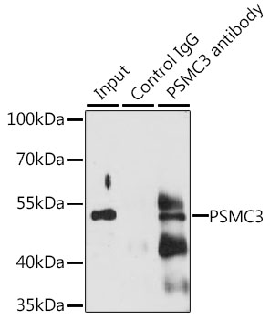 Anti-PSMC3 Antibody (CAB13345)