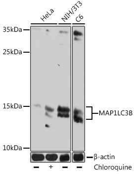 Anti-MAP1LC3B Mouse Monoclonal Antibody (CAB17424)