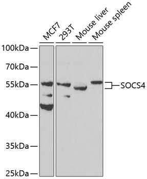 Anti-SOCS4 Polyclonal Antibody (CAB8003)